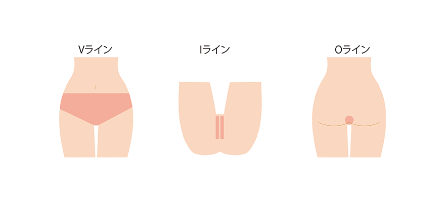 Vライン・Iライン・Oライン